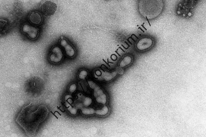 آنفولانزای H1N1 / سویه H1N1